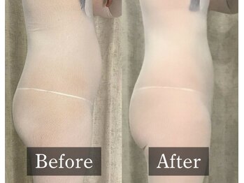 ココフィット(COCOFIT)の写真/ぽっこりお腹・厚みのある老け見えボディ卒業しませんか？