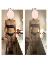 アクア エステティコ 亀有(ACQUA estetico)/ブライダル1 