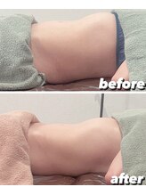 ユヴィラ(YUVIRA)/腸もみでお腹ボディメイク