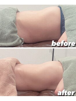 ユヴィラ(YUVIRA)/腸もみでお腹ボディメイク