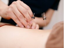 ノア鍼灸院 温灸堂(NOA鍼灸院)/