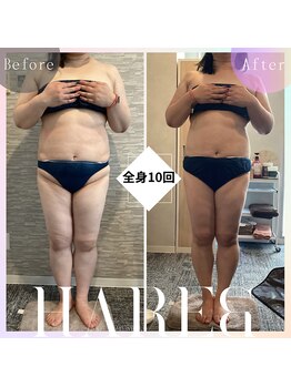 ハレアンド(Hare&)/40代全身10回目Before After
