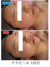 ユフラ(Juhla)/ララピール