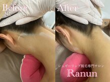 ラナン(Ranun)/シェービングで剃ってませんか？