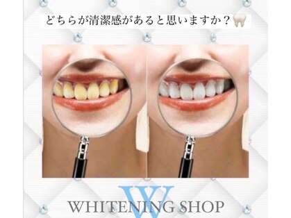 ホワイトニングショップ 船橋店の写真