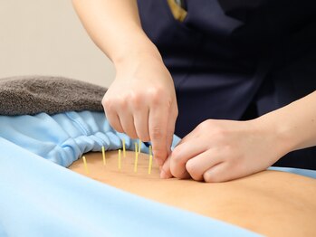 ヴィーライン 上大岡(VeLine)/湿布を使って誤魔化す腰痛に