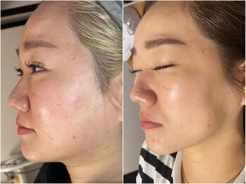 Beauty salon TCM 【小顔/たるみ/バストアップ】/赤筋に特化したEMS振動マシン