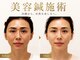 ウィル(will)の写真/国家資格所持者による結果重視の本格顔の整体・美容鍼灸サロン★シミ・シワ・肌トラブルにお悩みの方にも◎