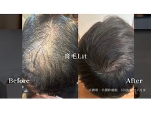 ビトウェルネス 池尻大橋(Bi to wellness)の雰囲気（【幹細胞導入マシン】肌土台・頭皮環境も整えボリュームUP）