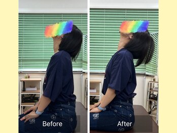 ナオル整体 春日部院(NAORU整体)/上を向くとつらい首の痛みが軽減