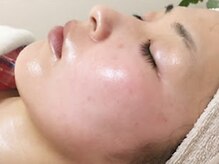グランシス