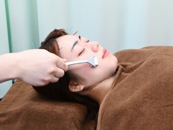 諏訪の杜鍼灸院の写真/【ニキビケア・肌質改善に特化！】ダーマ美容鍼30分￥4,400美容鍼で肌質がみるみる変わる感動体験を♪