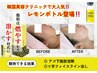 韓国肌管理◎【脂肪分解レモンボトル1cc注入】顔の脂肪燃焼ラジオ波付19,800