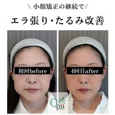 キュープ 広島店(Qpu)
