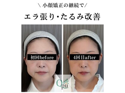 キュープ 広島店(Qpu)の写真