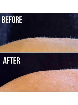 メローワックス 松本駅前店(MELLOW WAX)/選べるお顔１ヶ所