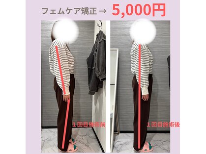 ルナ(Runa)の写真