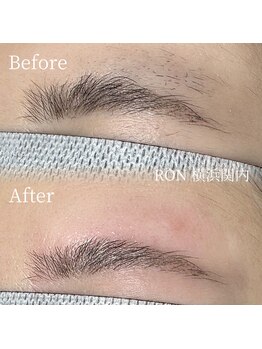 サロンロン 横浜関内(SALON RON)/眉毛脱毛/美容電気脱毛