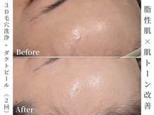 ゼアー(THERE FY.)/