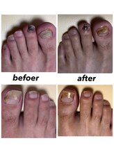 リゼラアンドコー 宇都宮陽南店/ドイツ式フットケア専門店