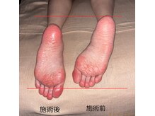 バリニーズ スパ ジャランジャラン(Balinese spa Jalan-Jalan)の雰囲気（足元の歪みが不調の原因に）