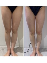 ルナグランデ(Luna grande.)/1回でこの変化！