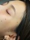 イーヨー 久留米店(Eyore)の写真/《産毛/角質/顔ダニ》をフェイスワックスで徹底除去!くすみ/毛穴汚れを改善し、明るく透明感のある艶肌に♪
