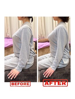 フォルム ボディアンドフェイス 恵比寿(Forme)/バストアップ矯正