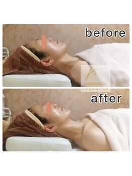 筋線美術コルギ 目黒店/大人気!筋線美術小顔コルギ