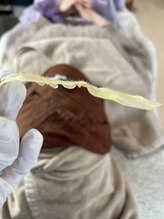 ミーミドットアイ(Mi-mi.i)/艶肌WAX脱毛★