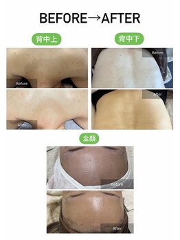 ケーナインエッセ(K9 esse)/ハーブピーリングBefore→After