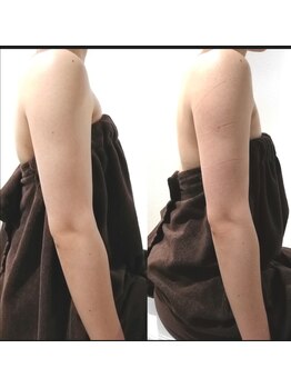 RiとBiのたまご/（ブライダル）体験コース