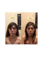 アジール 長岡リバーサイド千秋店(agir)/Before/After画像