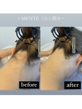 メンテ(MENTE)/うなじ美人