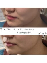 すずき接骨院/ホワイトスノーピール