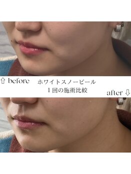 すずき接骨院/ホワイトスノーピール