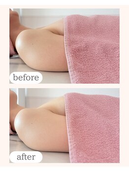 ワム(Wom)/バスト上部/デコルテボリューム