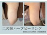 【2回目以降のご来店】二の腕ハーブピーリング│選べる2種のハーブ¥22,000