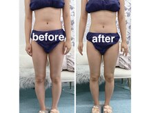 ハロ 南青山(HALO)/脂肪分解スタンプ40PUSH