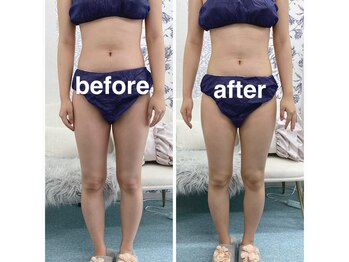 ハロ 南青山(HALO)/脂肪分解スタンプ40PUSH