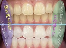 ホワイトニングショップ 八代店