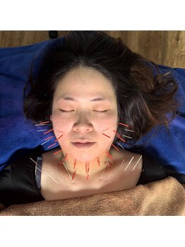 松山鍼灸マッサージ院/ウェディングドレスを着る前に！