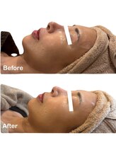 アールユー ギンザ(Ryou ginza)/肌管理トリートメント