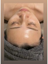 エヌ(enu)/プラズマ/炭酸/フェイシャル