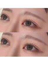 ヴァイス(VAICE)/マツパ