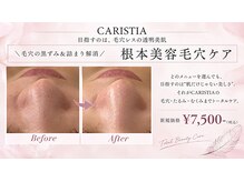 カリスティア(CARISTIA)