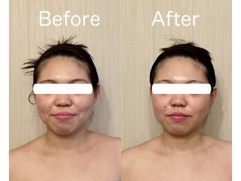 サロン ド シャルール/フェイシャル歪みも改善