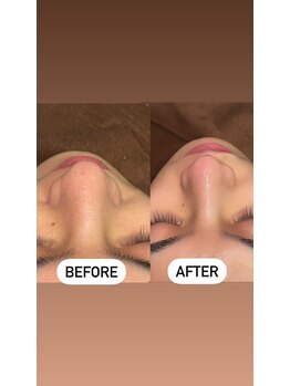 ソーレエルーナ(SOLE e LUNA)/毛穴洗浄 フェイシャルワックス