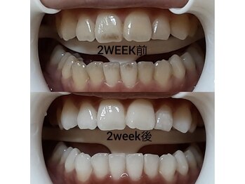 ホワイトニングセンター うるま江洲店/沖縄市・うるま市ホワイトニング