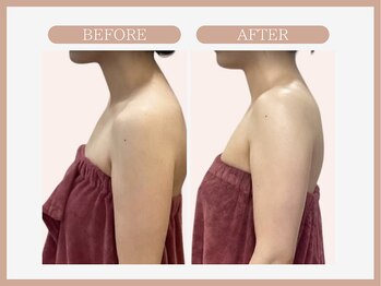 アコガレコガオ 盛岡店/